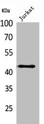 Western Blot analysis of Jurkat cells using E2F-4 Polyclonal Antibody