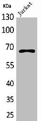 Western Blot analysis of Jurkat cells using ERα Polyclonal Antibody