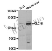 Western blot analysis of extracts of various cell lines, using CLCN1 antibody.