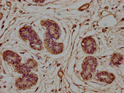 IHC image of CSB-PA005484LA01HU diluted at 1:100 and staining in paraffin-embedded human breast cancer performed on a Leica BondTM system. After dewaxing and hydration, antigen retrieval was mediated by high pressure in a citrate buffer (pH 6.0)....