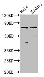 Western Blot Positive WB detected in: Hela whole cell lysate, Rat kidney tissue All lanes: CLCNKB antibody at 3µg/ml Secondary Goat polyclonal to rabbit IgG at 1/50000 dilution Predicted band size: 76, 57 kDa Observed band size: 76 kDa