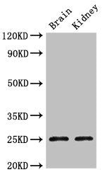 Western Blot Positive WB detected in: Mouse brain tissue, Mouse kidney tissue All lanes: CLDN10 antibody at 2.4ug/ml Secondary Goat polyclonal to rabbit IgG at 1/50000 dilution Predicted band size: 25, 23 kDa Observed band size: 25 kDa