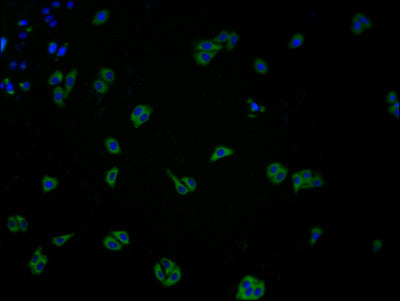 Immunofluorescence staining of HepG2 cells with CSB-PA005492LA01HU at 1:100, counter-stained with DAPI. The cells were fixed in 4% formaldehyde and blocked in 10% normal Goat Serum. The cells were then incubated with the antibody overnight at 4°C....