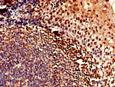 Immunohistochemistry of paraffin-embedded human tonsil tissue using CSB-PA005493LA01HU at dilution of 1:100