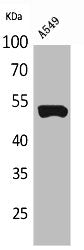 Western Blot analysis of A549 cells using Cytokeratin 8 Polyclonal Antibody