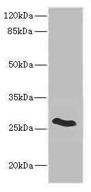 Western blot All lanes: CLDN18 antibody IgG at 5.02ug/ml + Rat heart tissue Secondary Goat polyclonal to rabbit IgG at 1/10000 dilution Predicted band size: 28 kDa Observed band size: 28 kDa