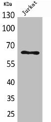 Western Blot analysis of Jurkat cells using Keratin-pan Polyclonal Antibody