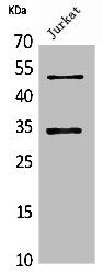 Western Blot analysis of Jurkat cells using MyoD Polyclonal Antibody