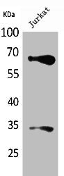 Western Blot analysis of Jurkat cells using Nrf2 Polyclonal Antibody