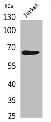 Western Blot analysis of Jurkat cells using NFκB-p65 Polyclonal Antibody