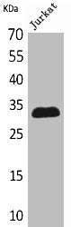 Western Blot analysis of Jurkat cells using p57 Polyclonal Antibody