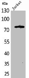 Western Blot analysis of Jurkat cells using p73 Polyclonal Antibody
