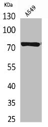 Western Blot analysis of A549 cells using p73 Polyclonal Antibody