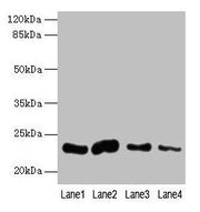 Western blot All lanes: CLEC3A antibody at 0.4µg/ml Lane 1: Mouse liver tissue Lane 2: Mouse kidney tissue Lane 3: Mouse brain tissue Lane 4: Mouse lung tissue Secondary Goat polyclonal to rabbit IgG at 1/10000 dilution Predicted band size: 23 kDa...