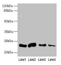 Western blot All lanes: CLEC3A antibody at 0.4µg/ml Lane 1: Mouse liver tissue Lane 2: Mouse kidney tissue Lane 3: Mouse brain tissue Lane 4: Mouse lung tissue Secondary Goat polyclonal to rabbit IgG at 1/10000 dilution Predicted band size: 23 kDa...