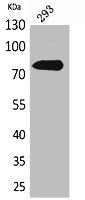 Western Blot analysis of 293 cells using Btk Polyclonal Antibody.