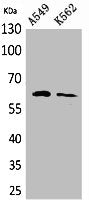 Western Blot analysis of A549, K562 cells using Smad1 Polyclonal Antibody.