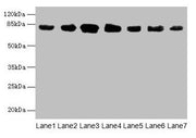 Western blot All lanes: CLGN antibody at 7µg/ml Lane 1: Mouse brain tissue Lane 2: Mouse lung tissue Lane 3: Jurkat whole cell lysate Lane 4: HepG2 whole cell lysate Lane 5: PC-3 whole cell lysate Lane 6: Hela whole cell lysate Lane 7: HL60 whole...