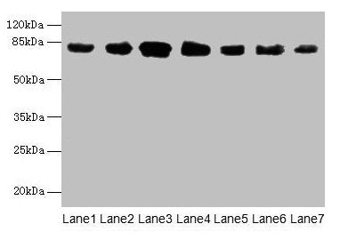 Western blot All lanes: CLGN antibody at 7µg/ml Lane 1: Mouse brain tissue Lane 2: Mouse lung tissue Lane 3: Jurkat whole cell lysate Lane 4: HepG2 whole cell lysate Lane 5: PC-3 whole cell lysate Lane 6: Hela whole cell lysate Lane 7: HL60 whole...