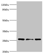 Western blot All lanes: Chloride intracellular channel protein 1 antibody at 4ug/ml Lane 1: Hela whole cell lysate Lane 2: Jurkat whole cell lysate Lane 3: MCF-7 whole cell lysate Secondary Goat polyclonal to rabbit IgG at 1/10000 dilution Predict...