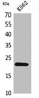 Western Blot analysis of K562 cells using IL-6 Polyclonal Antibody.