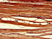 Immunohistochemistry of paraffin-embedded human skeletal muscle tissue using CSB-PA005547LA01HU at dilution of 1:100
