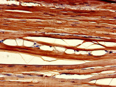 Immunohistochemistry of paraffin-embedded human skeletal muscle tissue using CSB-PA005547LA01HU at dilution of 1:100