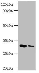 Western blot All lanes: Chloride intracellular channel protein 4 antibody at 5ug/ml Lane 1: Mouse kidney tissue Lane 2: Mouse ovarian tissue Secondary Goat polyclonal to rabbit IgG at 1/10000 dilution Predicted band size: 29 kDa Observed band size...