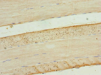 Immunohistochemistry of paraffin-embedded human skeletal muscle tissue using CSB-PA005557ESR1HU at dilution of 1:100