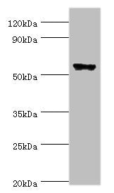 Western blot All lanes: CLK2 antibody at 5ug/ml + Hela whole cell lysate Secondary Goat polyclonal to rabbit IgG at 1/10000 dilution Predicted band size: 61, 18, 60 kDa Observed band size: 61 kDa