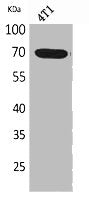 Western Blot analysis of 4T1 cells using Amphiphysin II Polyclonal Antibody.