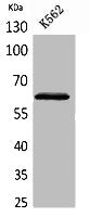 Western Blot analysis of K562 cells using HPA1 Polyclonal Antibody.