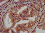 IHC image of CSB-PA005567LA01HU diluted at 1:300 and staining in paraffin-embedded human prostate tissue performed on a Leica BondTM system. After dewaxing and hydration, antigen retrieval was mediated by high pressure in a citrate buffer (pH 6.0)...