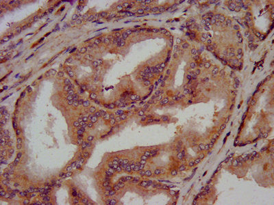 IHC image of CSB-PA005567LA01HU diluted at 1:300 and staining in paraffin-embedded human prostate tissue performed on a Leica BondTM system. After dewaxing and hydration, antigen retrieval was mediated by high pressure in a citrate buffer (pH 6.0)...