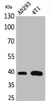 Western Blot analysis of AD293, 4T1 cells using Troponin T-C Polyclonal Antibody.
