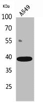 Western Blot analysis of A549 cells using CGR19 Polyclonal Antibody.