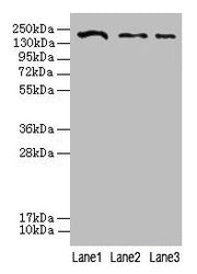Western blot All lanes: CLTCL1 antibody at 2µg/ml Lane 1: Jurkat whole cell lysate Lane 2: NIH/3T3 whole cell lysate Lane 3: A431 whole cell lysate Secondary Goat polyclonal to rabbit IgG at 1/10000 dilution Predicted band size: 188, 181 kDa Obser...