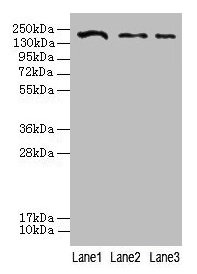 Western blot All lanes: CLTCL1 antibody at 2µg/ml Lane 1: Jurkat whole cell lysate Lane 2: NIH/3T3 whole cell lysate Lane 3: A431 whole cell lysate Secondary Goat polyclonal to rabbit IgG at 1/10000 dilution Predicted band size: 188, 181 kDa Obser...