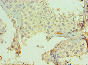 Immunohistochemistry of paraffin-embedded human testis tissue using CSB-PA005599ESR1HU at dilution of 1:100
