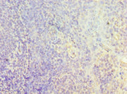 Immunohistochemistry of paraffin-embedded human tonsil tissue using CSB-PA005599ESR2HU at dilution of 1:100