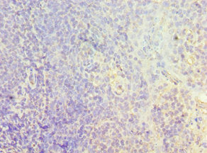 Immunohistochemistry of paraffin-embedded human tonsil tissue using CSB-PA005599ESR2HU at dilution of 1:100