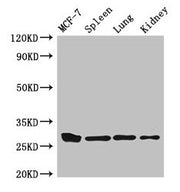 Western Blot Positive WB detected in: MCF-7 whole cell lysate, Mouse spleen tissue, Mouse lung tissue, Mouse kidney tissue All lanes: CMA1 antibody at 3µg/ml Secondary Goat polyclonal to rabbit IgG at 1/50000 dilution Predicted band size: 28, 15 k...