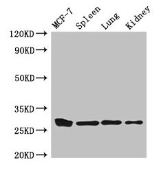 Western Blot Positive WB detected in: MCF-7 whole cell lysate, Mouse spleen tissue, Mouse lung tissue, Mouse kidney tissue All lanes: CMA1 antibody at 3µg/ml Secondary Goat polyclonal to rabbit IgG at 1/50000 dilution Predicted band size: 28, 15 k...
