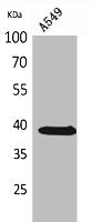 Western Blot analysis of A549 cells using NTCP Polyclonal Antibody.