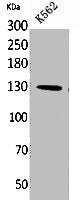Western Blot analysis of K562 cells using Apaf-1 Polyclonal Antibody.