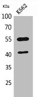 Western Blot analysis of K562 cells using IL-2Rγ Polyclonal Antibody.