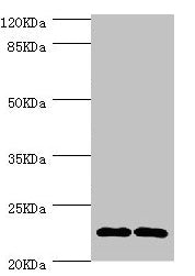 Western blot All lanes: CMPK1 antibody at 3.55µg/ml Lane 1: 293T whole cell lysate Lane 2: Hela whole cell lysate Secondary Goat polyclonal to rabbit IgG at 1/10000 dilution Predicted band size: 23, 17 kDa Observed band size: 23 kDa