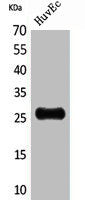 Western Blot analysis of HuvEc cells using CacyBP Polyclonal Antibody.