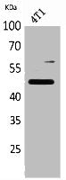 Western Blot analysis of 4T1 cells using AACT Polyclonal Antibody.