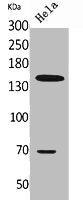 Western Blot analysis of HeLa cells using CD42b Polyclonal Antibody.